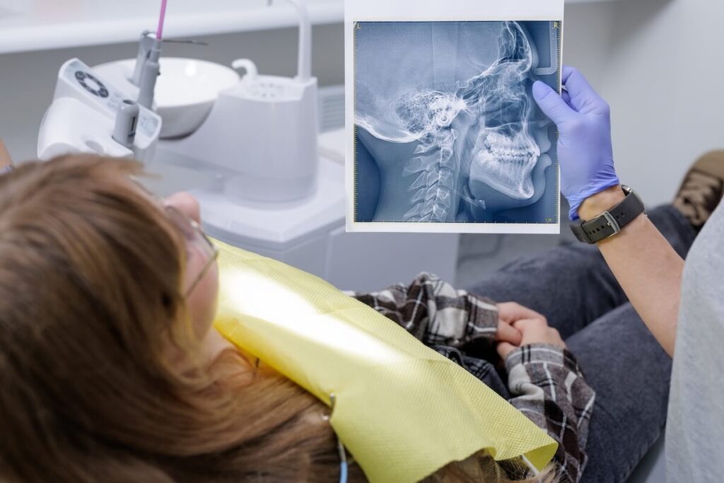 cephalometric-xray