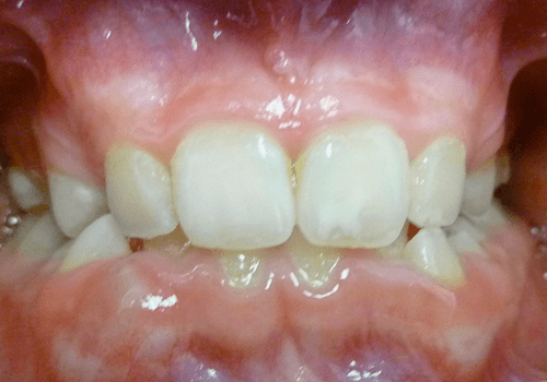 Before