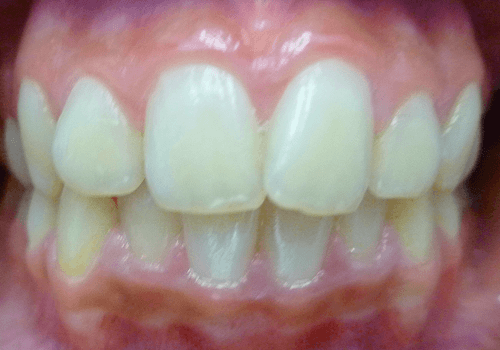 Before