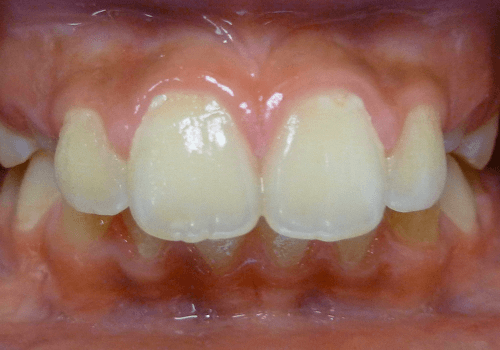 Before